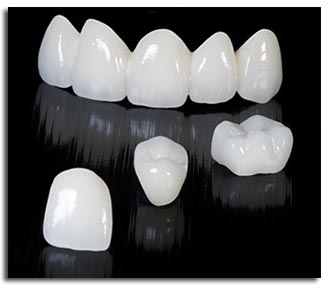 Răng sứ Cercon bền đẹp không phai màu, trắng sáng tự nhiên như răng thật