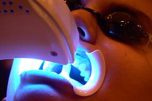 Tẩy Trắng Răng An Toàn Hiệu quả nhất bằng đèn Laser trong lúc Thực hiện Tẩy Trắng Răng Tại Phòng Khám Nha Khoa