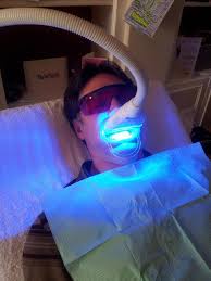 Tẩy trắng răng bằng đèn laser